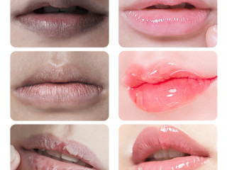 1pc-lips-pink-fresh-lightening-bleaching-cream-treatment-remove-dark-smoke-lips-lip-balm