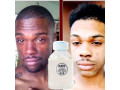 dark-skin-permanent-whitening-lightening-small-1