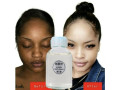 dark-skin-permanent-whitening-lightening-small-0