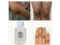 dark-skin-permanent-whitening-lightening-small-5