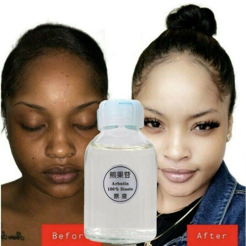 dark-skin-permanent-whitening-lightening-big-0