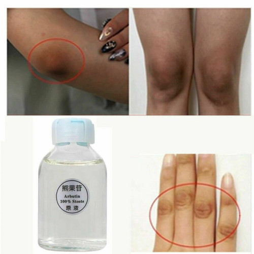 dark-skin-permanent-whitening-lightening-big-5